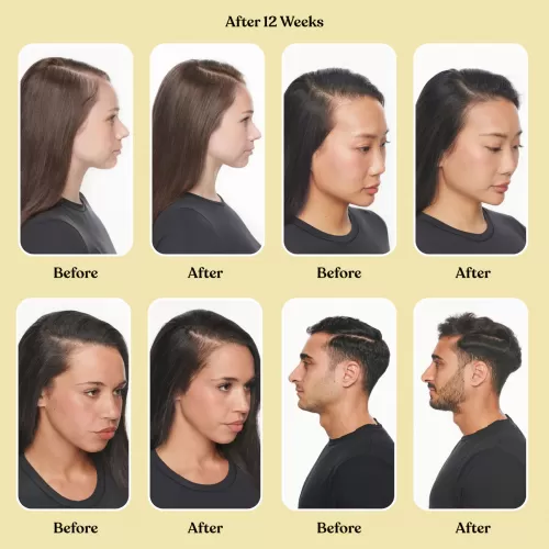LEMME - GROW HAIR GROWTH & ANTI-SHEDDING CAPSULES