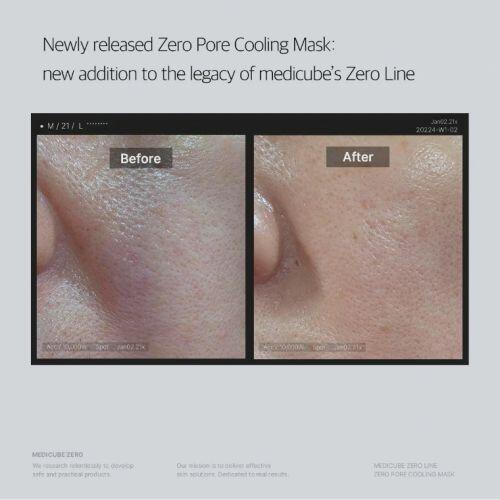 MEDICUBE - ZERO PORE COOLING MASK